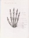 bones of left hand palmer aspect