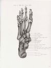 bones of right foot plantar aspect