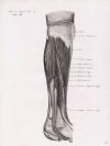 front and lateral side of right leg