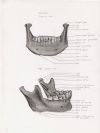 mandible anterior view